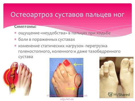 Причины колющей боли в суставах пальцев ног и способы ее устранения